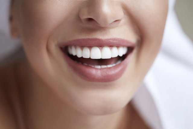 Is Teeth Whitening Right for You